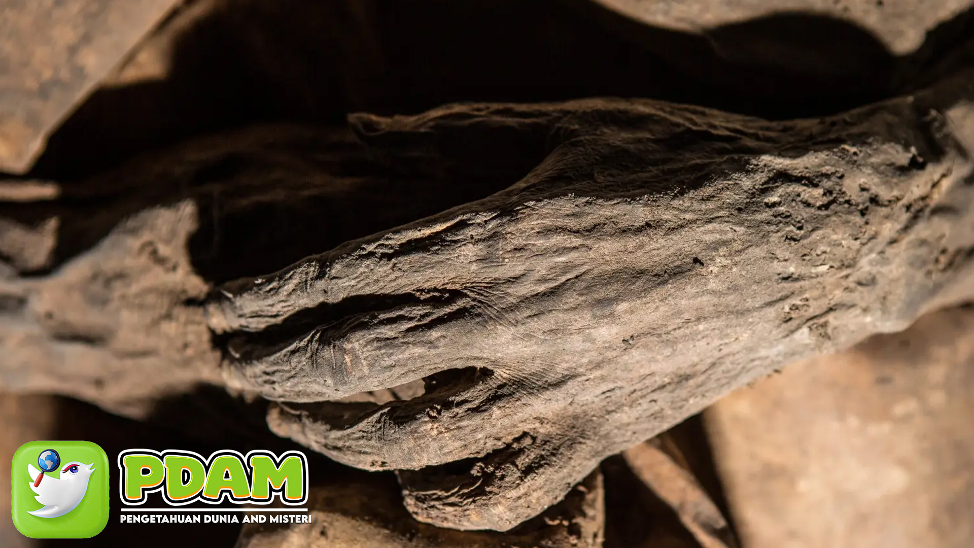 Mumi Lithuania: Misteri Virus Cacar Pembunuh 300 Juta Manusia